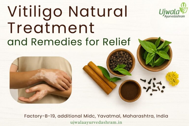 Vitiligo natural treatment