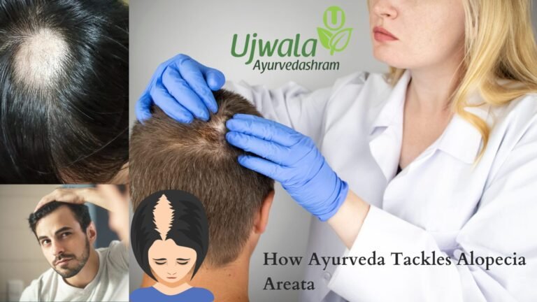 Alopecia Areata