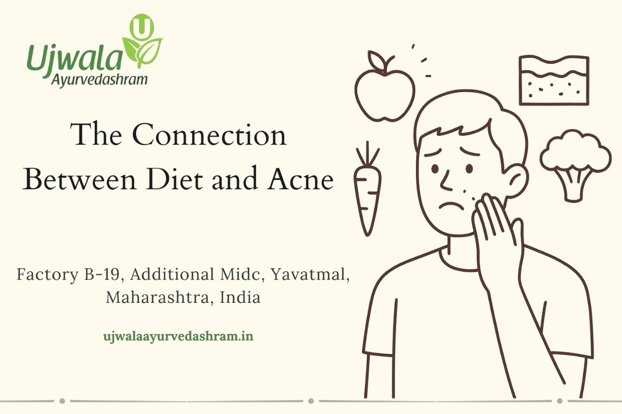 Connection between diet and acne